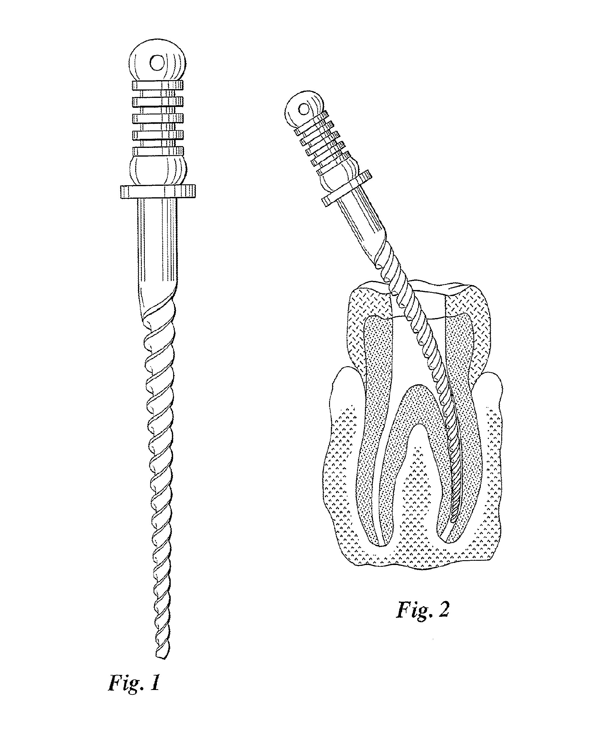 Fatigue-Resistant Nitinol Instrument