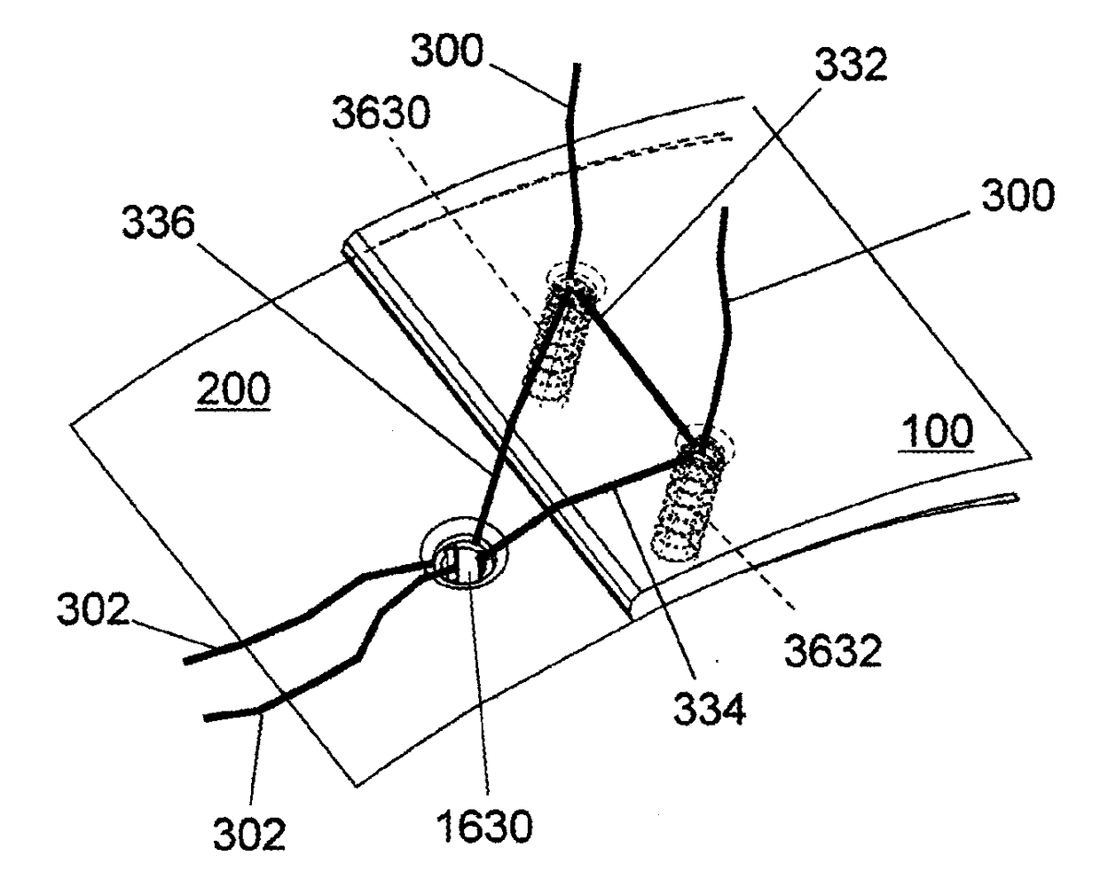 Multiple implant constructions and fixation methods associated therewith