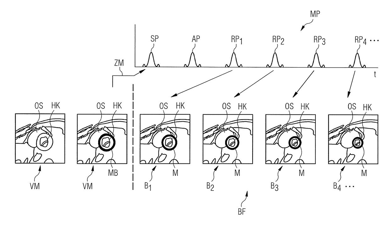 Method for determining a magnetic resonance control sequence, and magnetic resonance system operable according to the control sequence