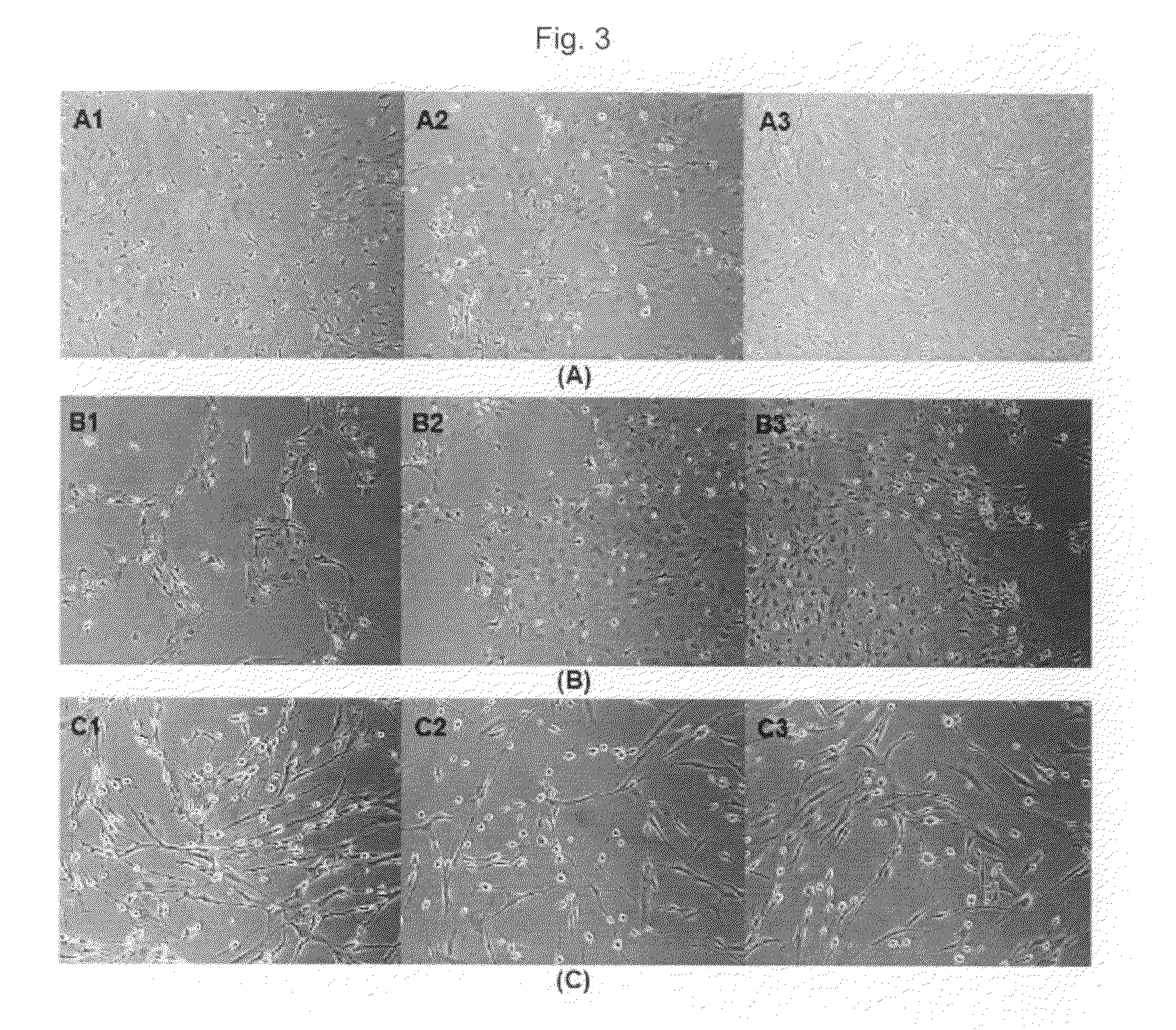 Neuronal differentiation method of adult stem cells using small molecules