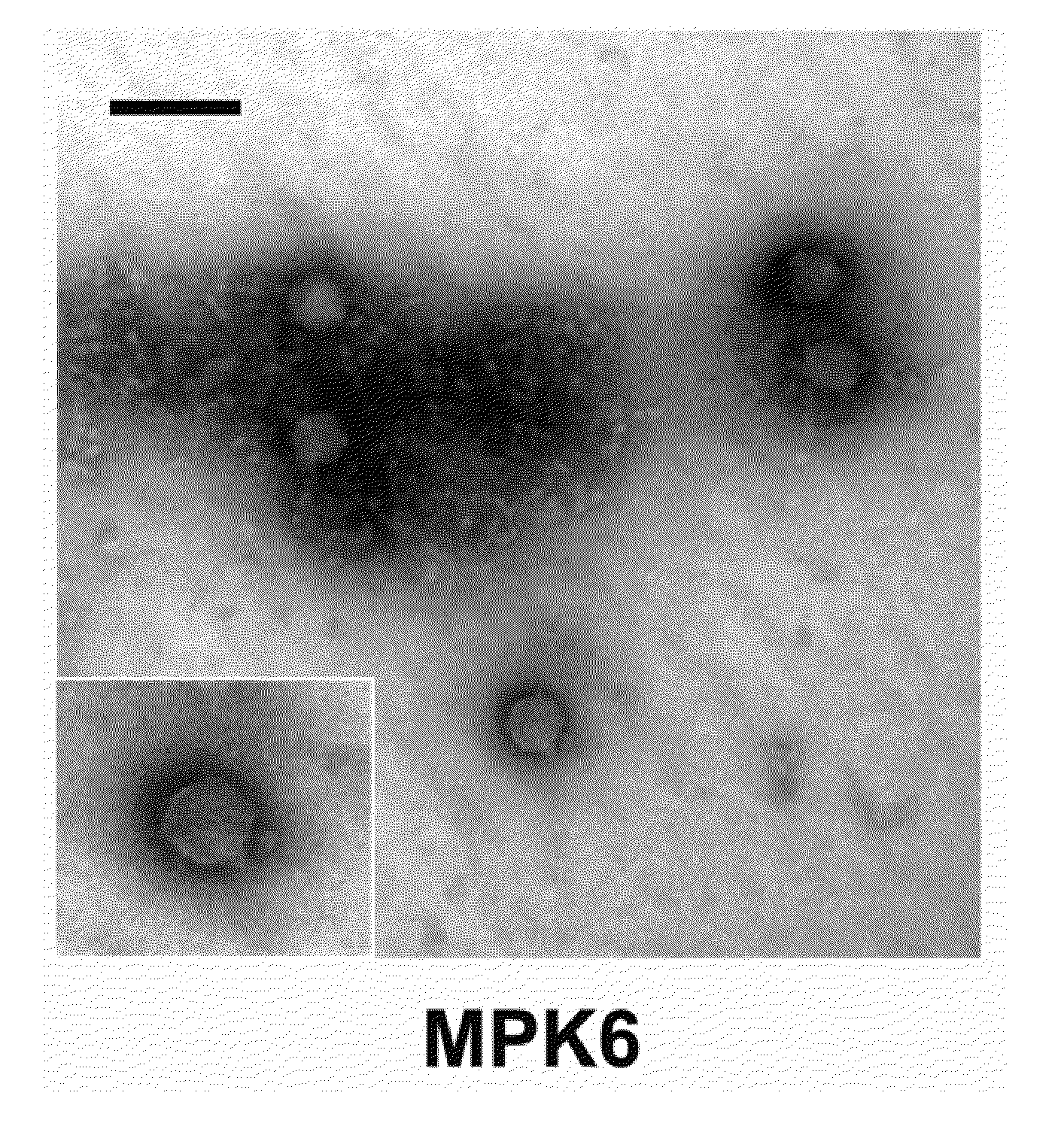 Phage Therapy Against Pseudomonas Aeruginosa