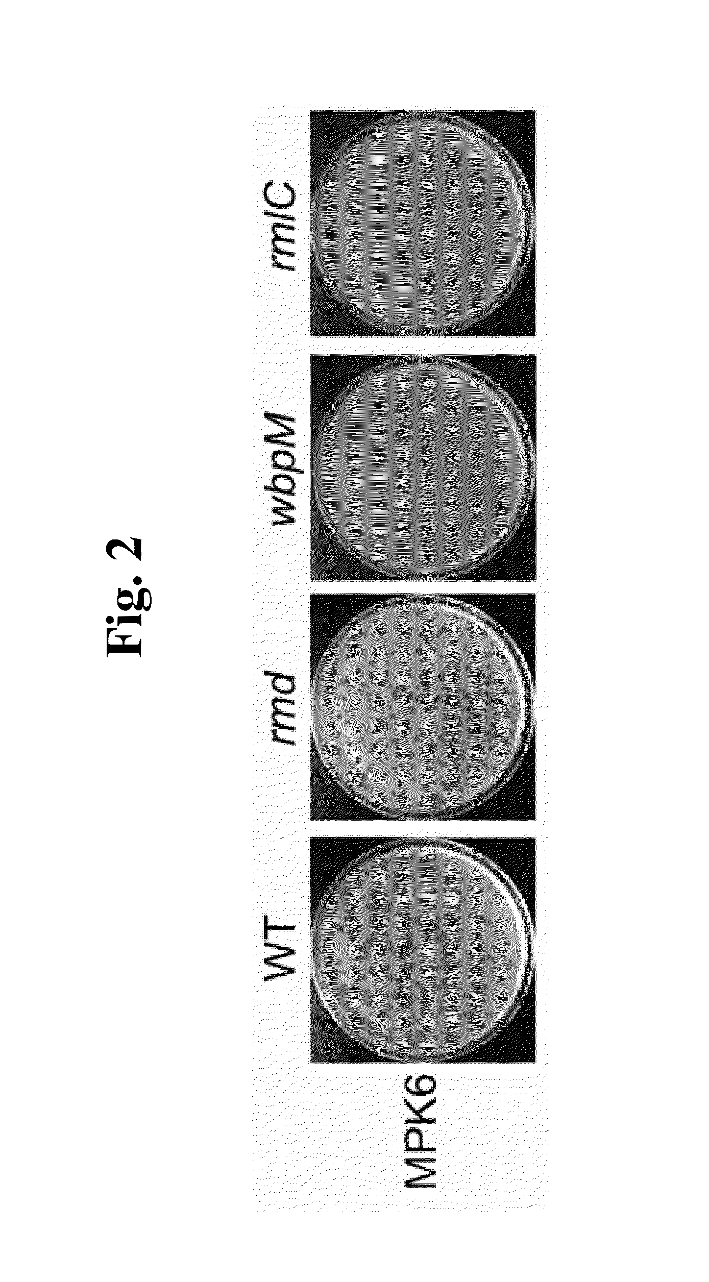 Phage Therapy Against Pseudomonas Aeruginosa