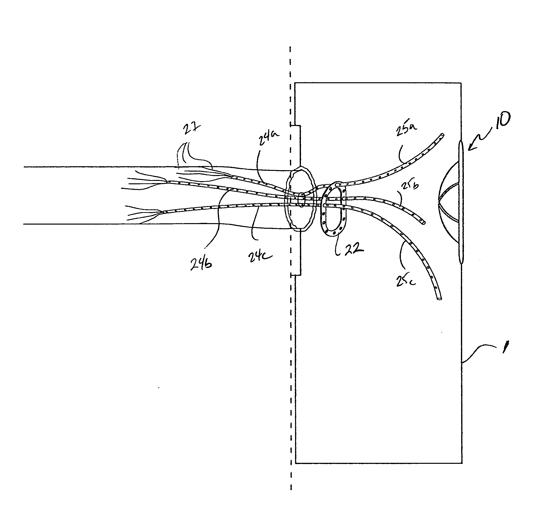 Apparatus for ostomy devices