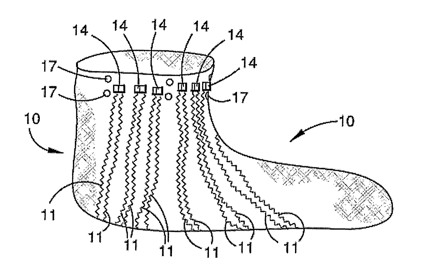 System, garment and method