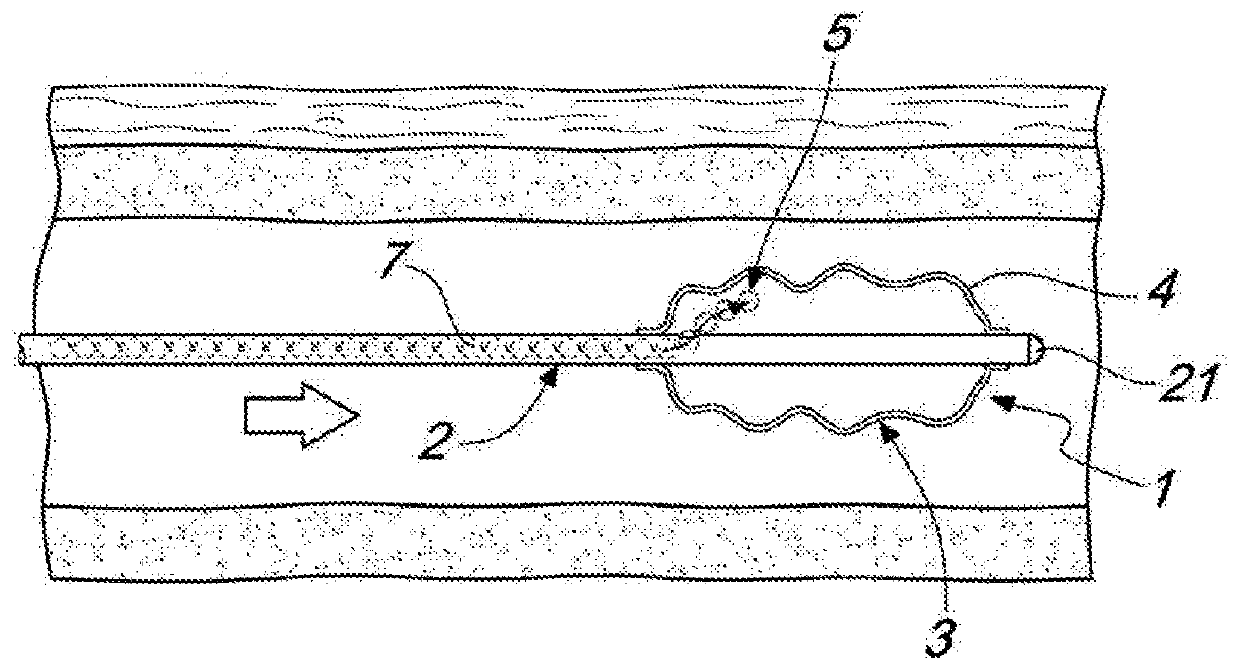 Endoscopic guide, in particular for colonoscopy, and system for endoscopy comprising such a guide