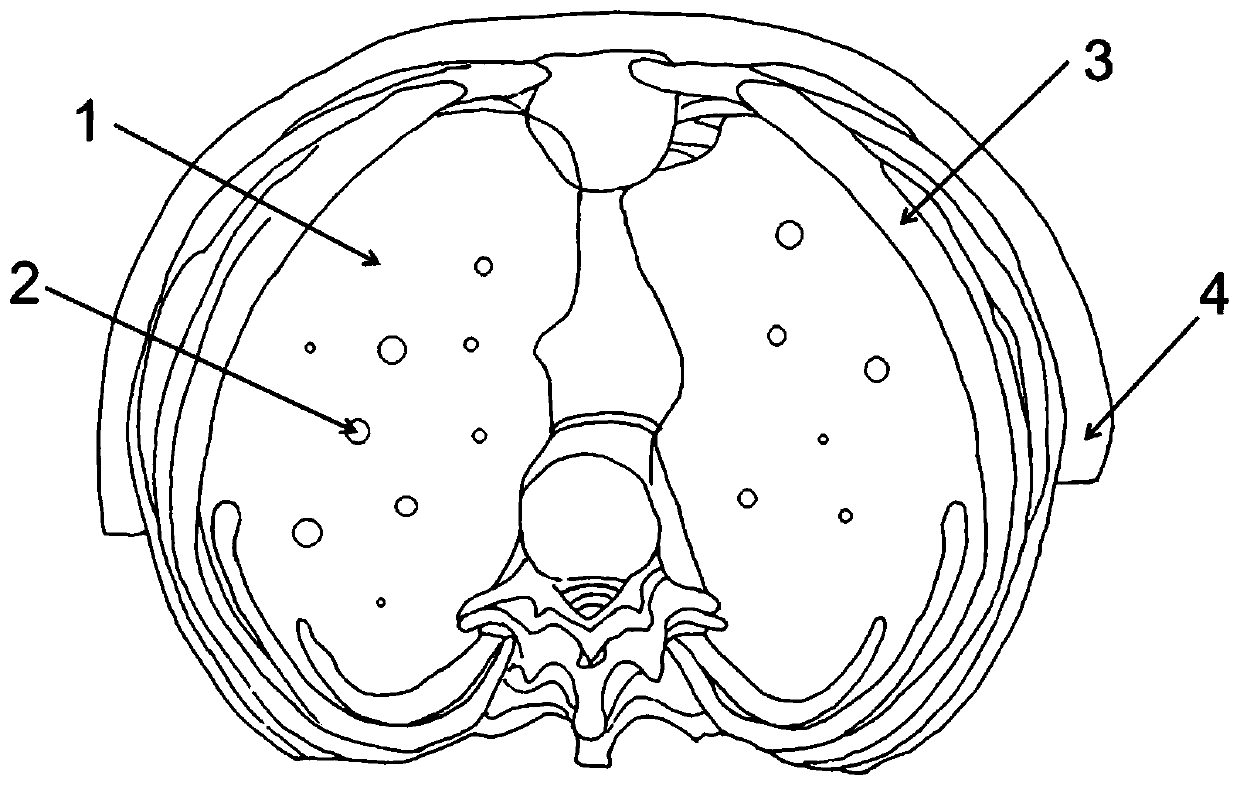 Percutaneous lung puncture model and manufacturing method thereof