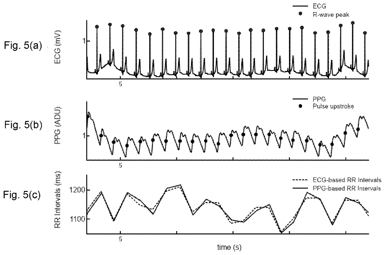 Method for classifying photoplethysmography pulses and monitoring of cardiac arrhythmias