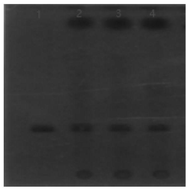 Particle composition capable of harmonizing stomach and tonifying spleen, and preparation method of particle composition