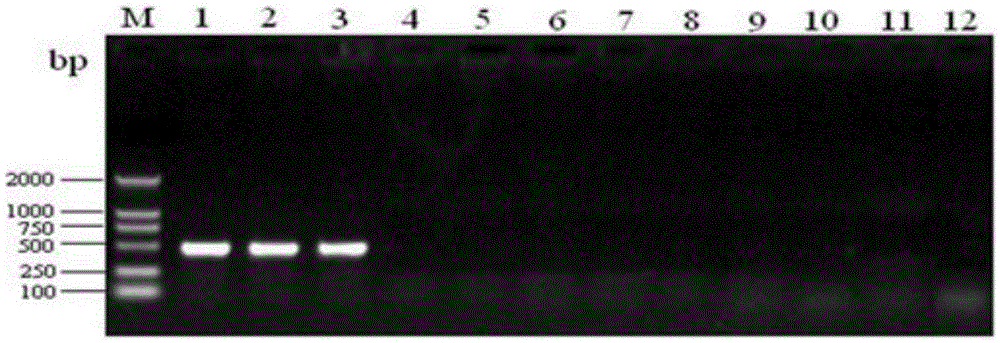 Rapid qualitative and quantitative detection kit for enterococcus faecium in feed as well as detection method and application