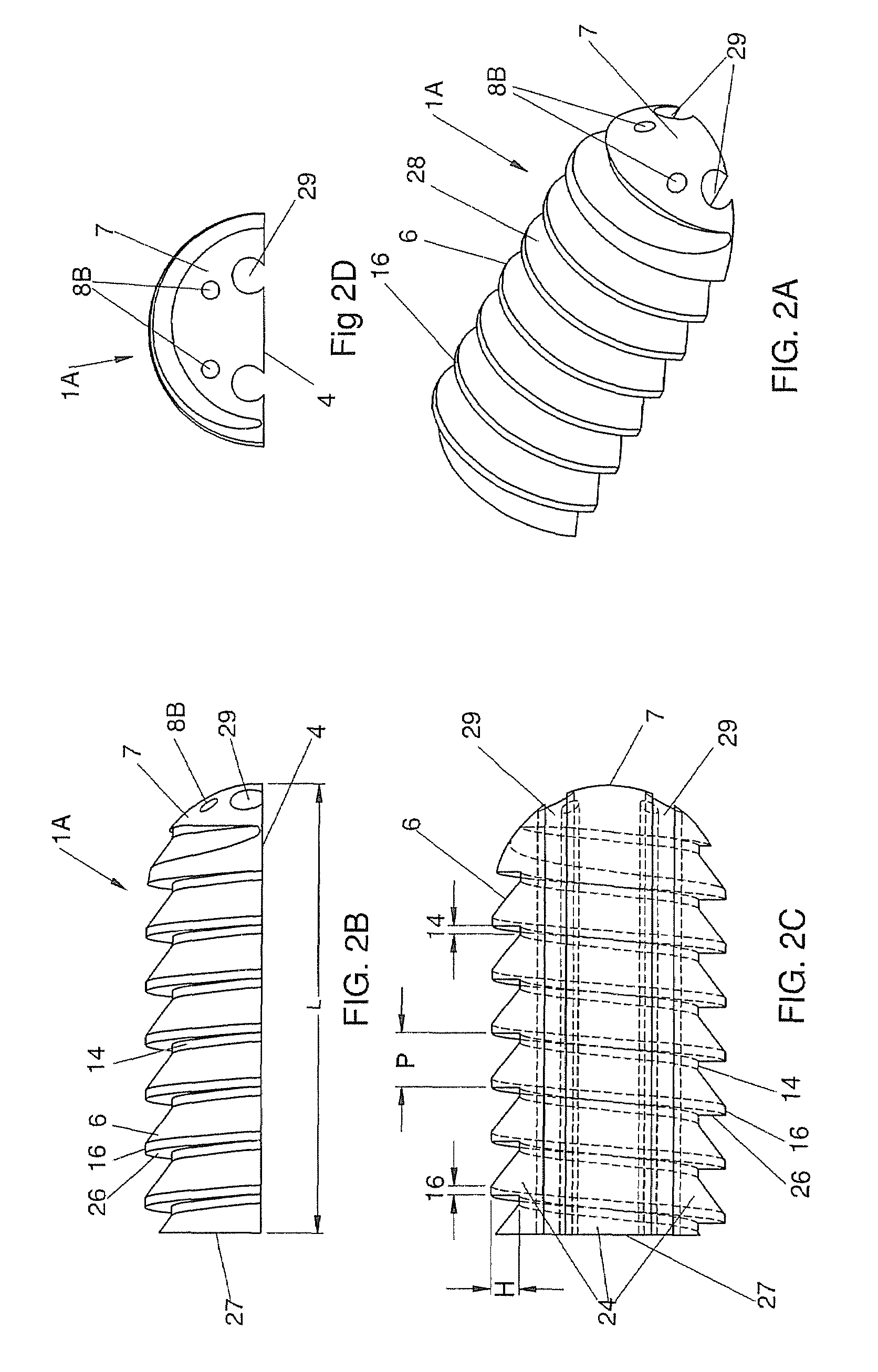 Self fixing assembled bone-tendon-bone graft