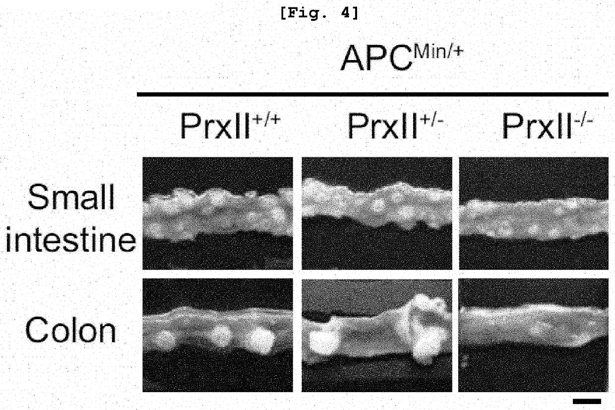 Pharmaceutical composition comprising substance inhibiting enzymatic activity of peroxiredoxin 2 as effective ingredient for treatment of colorectal cancer