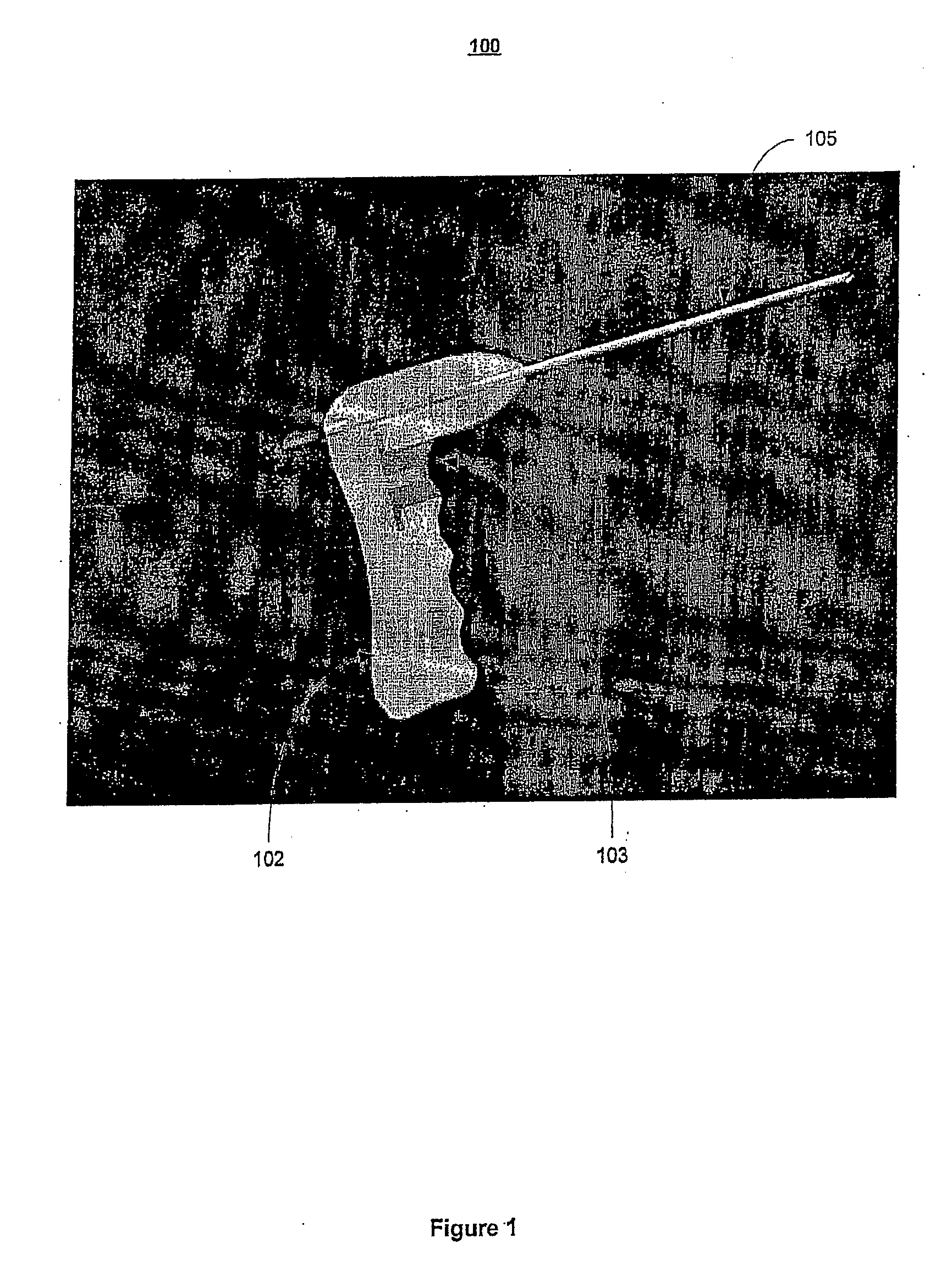 Device and method for rapid aspiration and collection of body tissue from within an enclosed body space