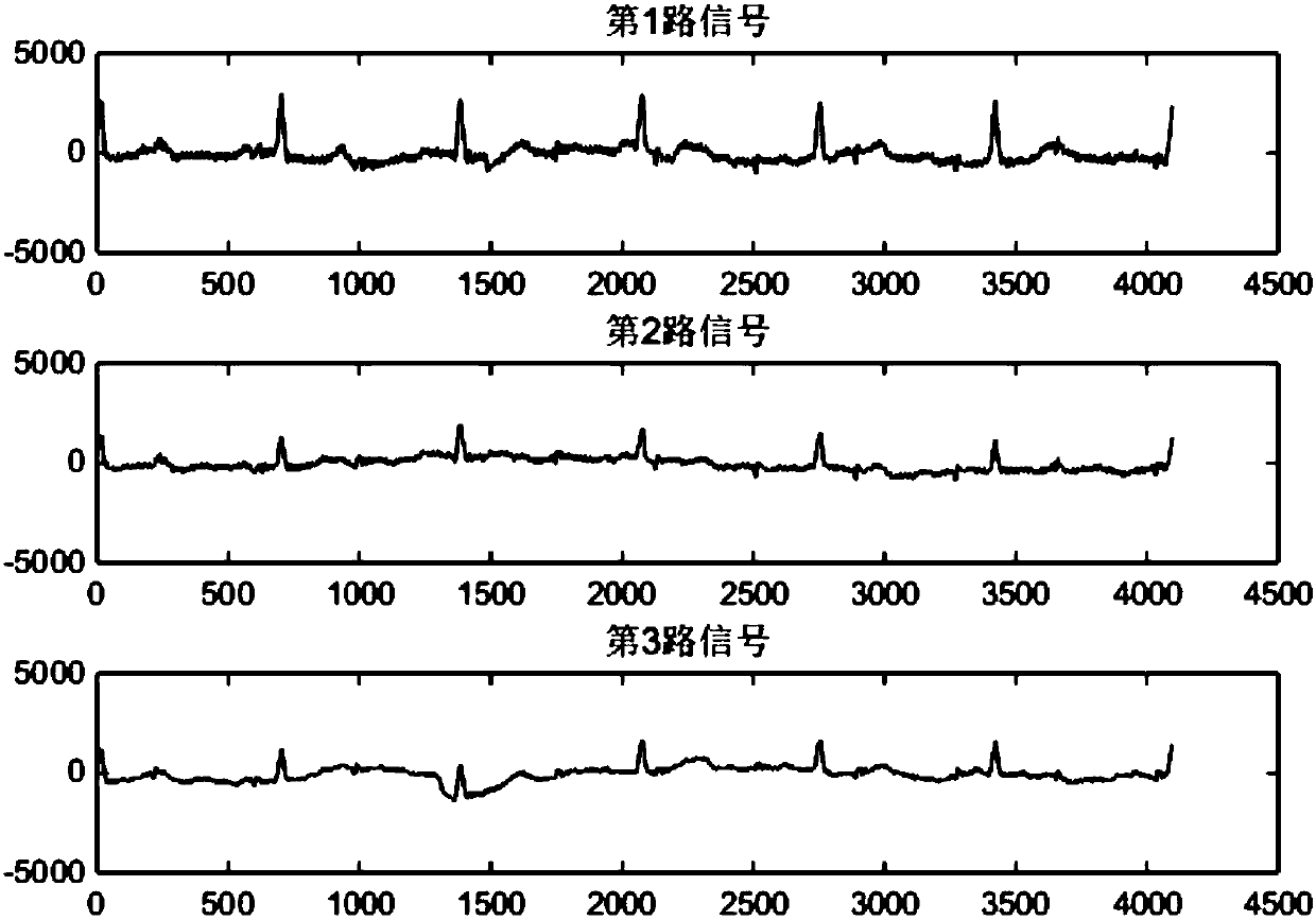 Hilbert transform based fetal electrocardio extraction and fetal heart rate recognition method