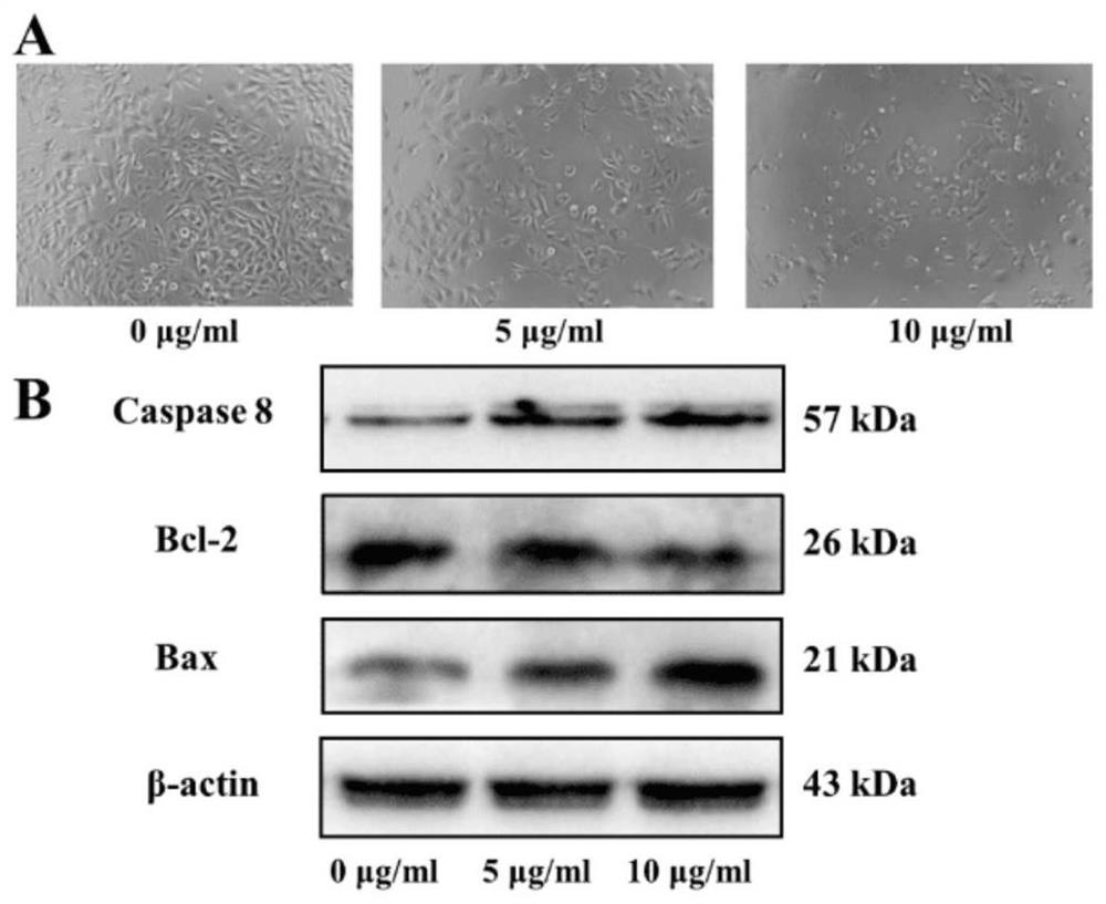 Application of diosmetin in preparation of medicine for treating prostatic cancer