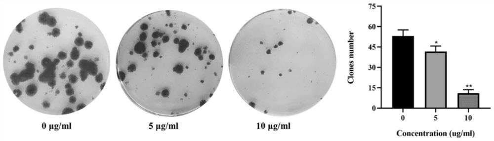 Application of diosmetin in preparation of medicine for treating prostatic cancer