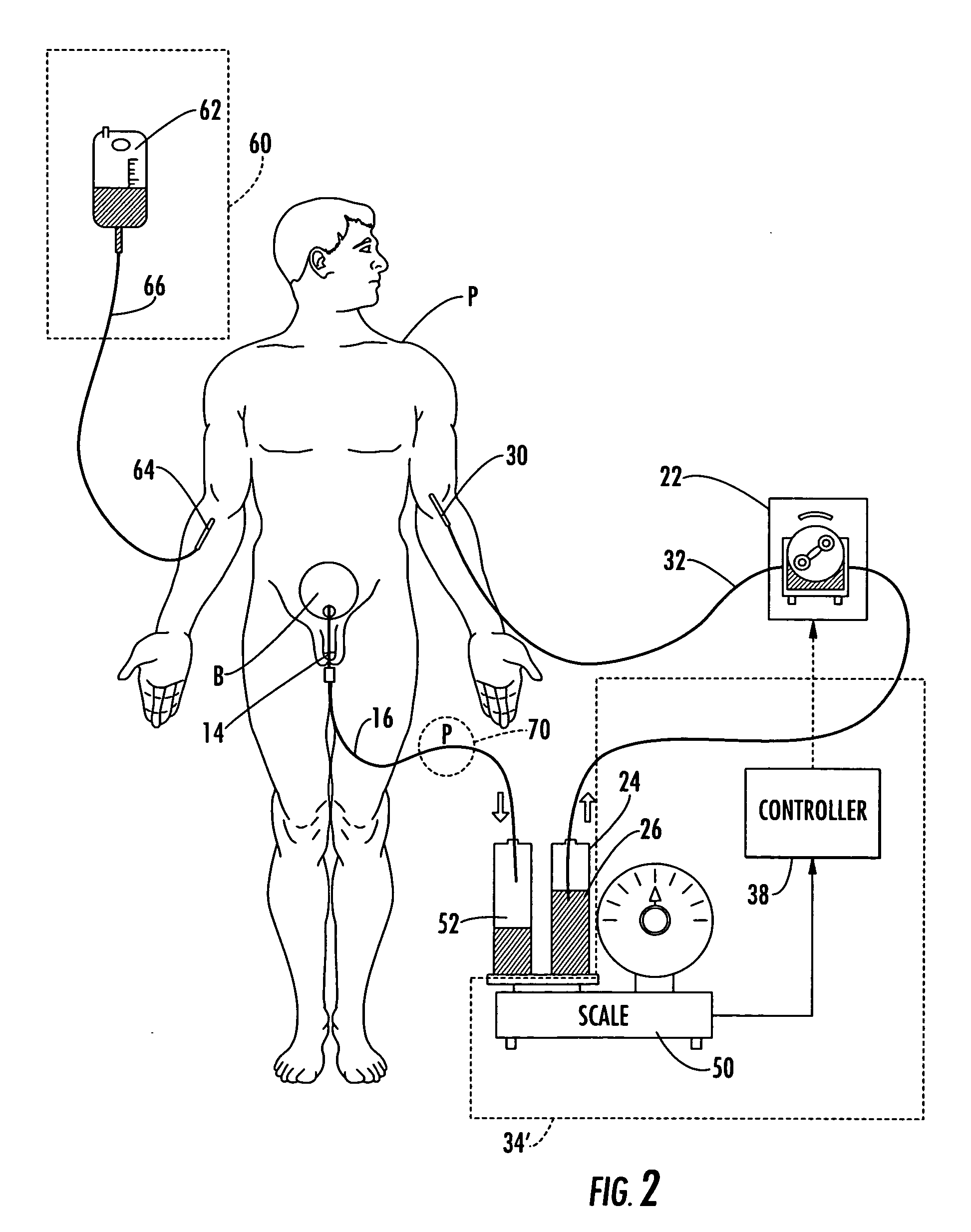 Patient hydration system and method