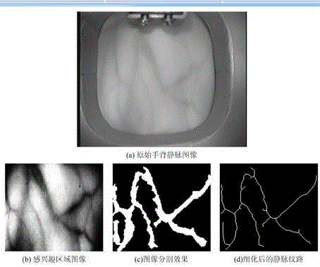 Back-of-hand vein line extraction method based on local maximum between-class variance and mathematical morphology