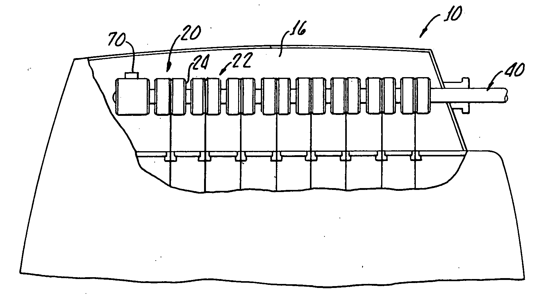 Pigtail spring contacts for implanted medical devices