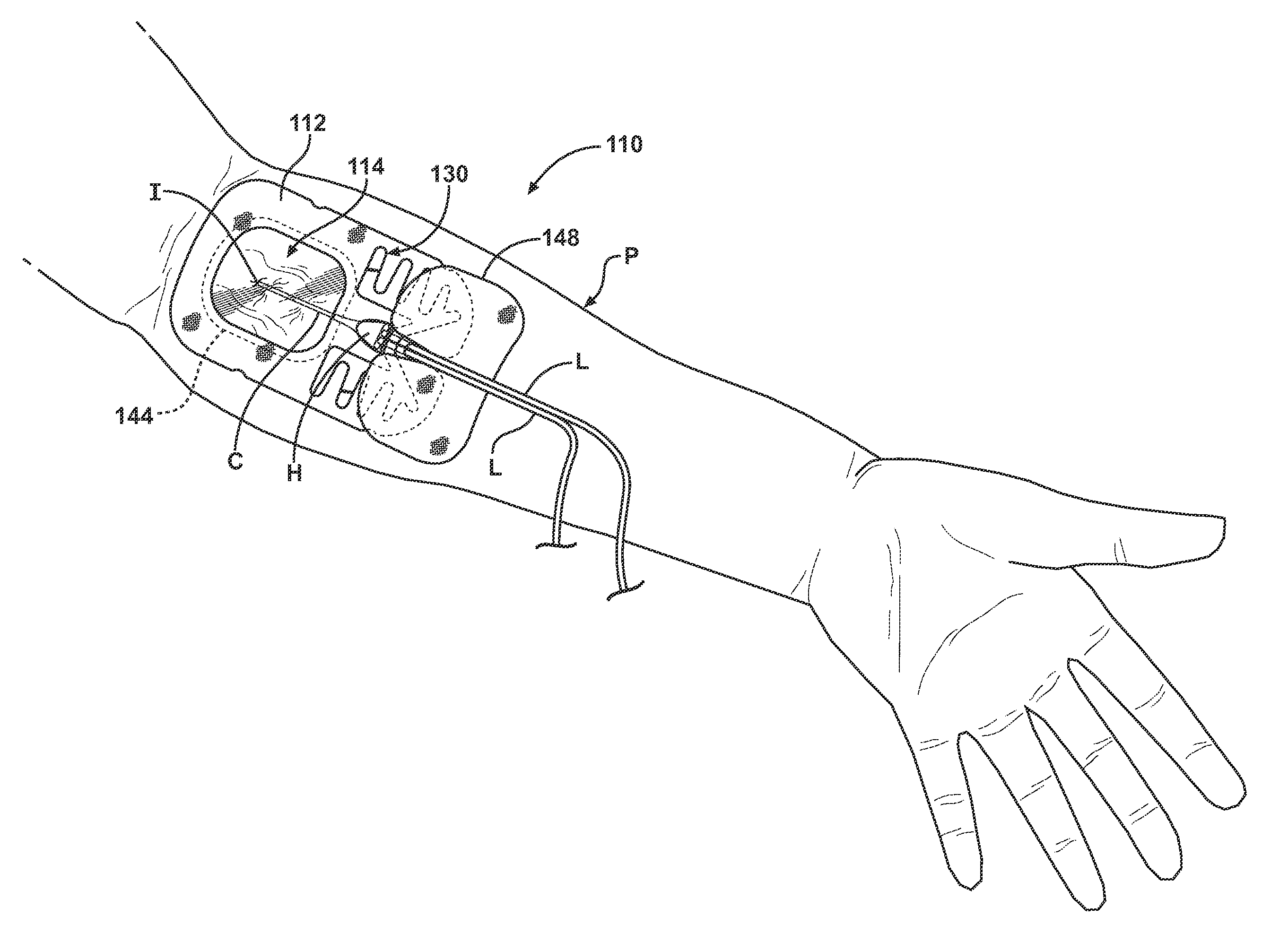 Window dressing having integral anchor