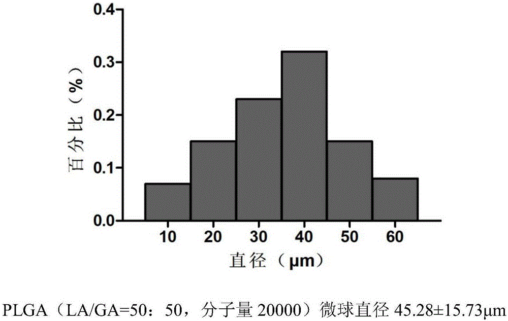 Temozolomide slow-release system as well as preparation method and application thereof