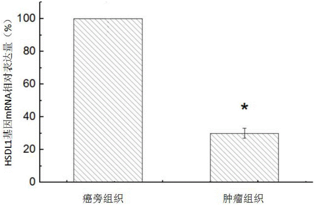 Application of HSDL1 to diagnosis and treatment of osteosarcoma