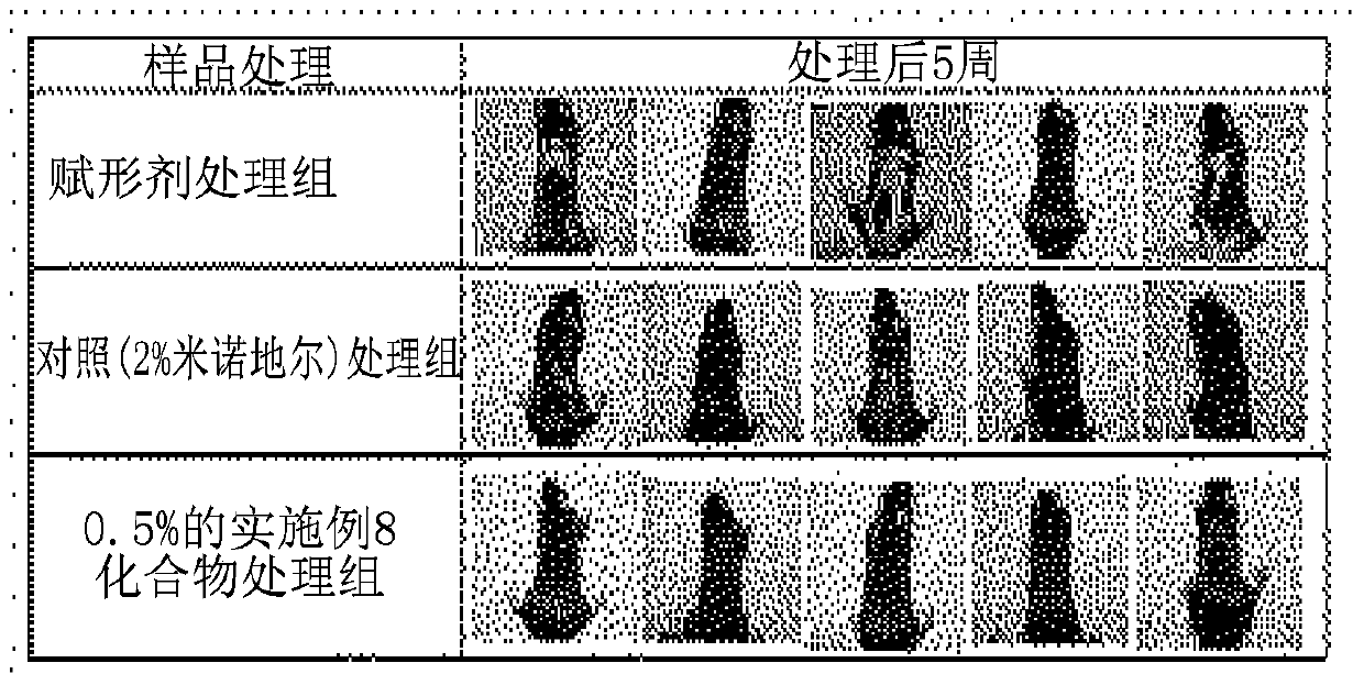 Composition for preventing hair loss and accelerating hair growth