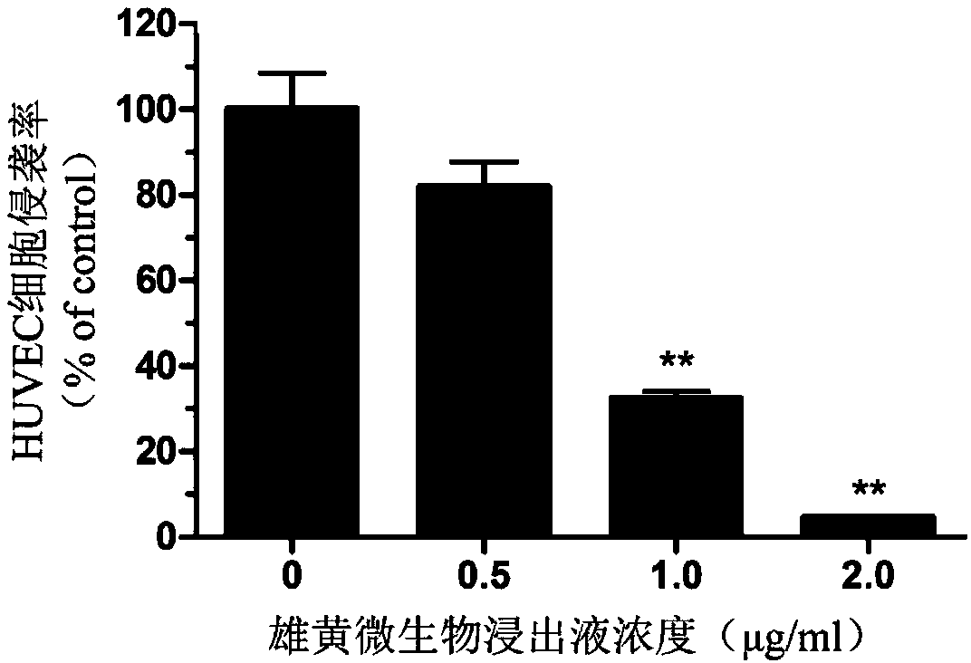 Application of realgar microbiological leaching liquid in preparation of drug for inhibiting angiogenesis