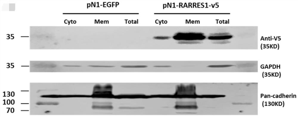 Application of retinoic acid receptor reactive protein 1 as a biomarker in chronic kidney disease