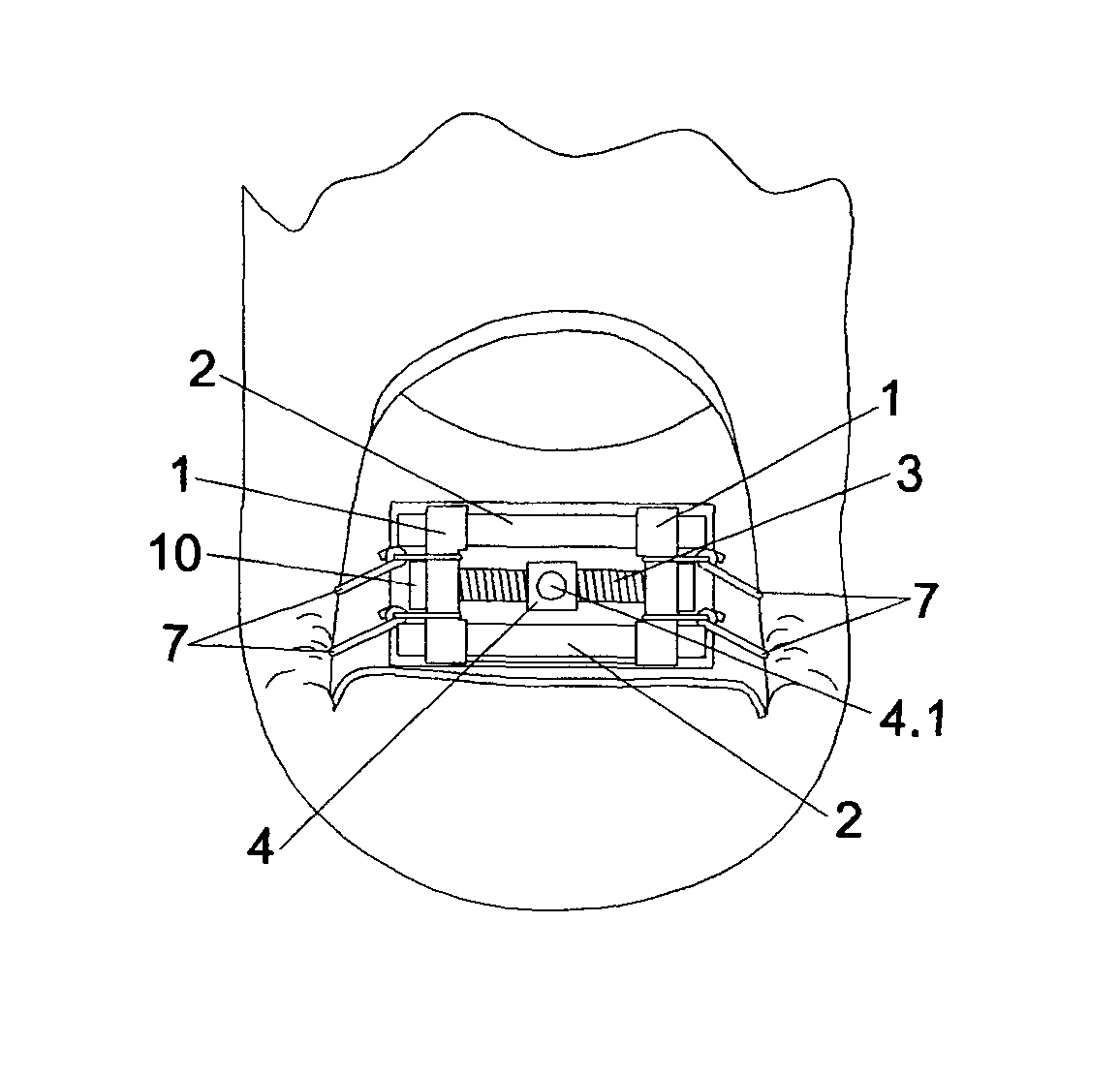 Screw nail correcting apparatus