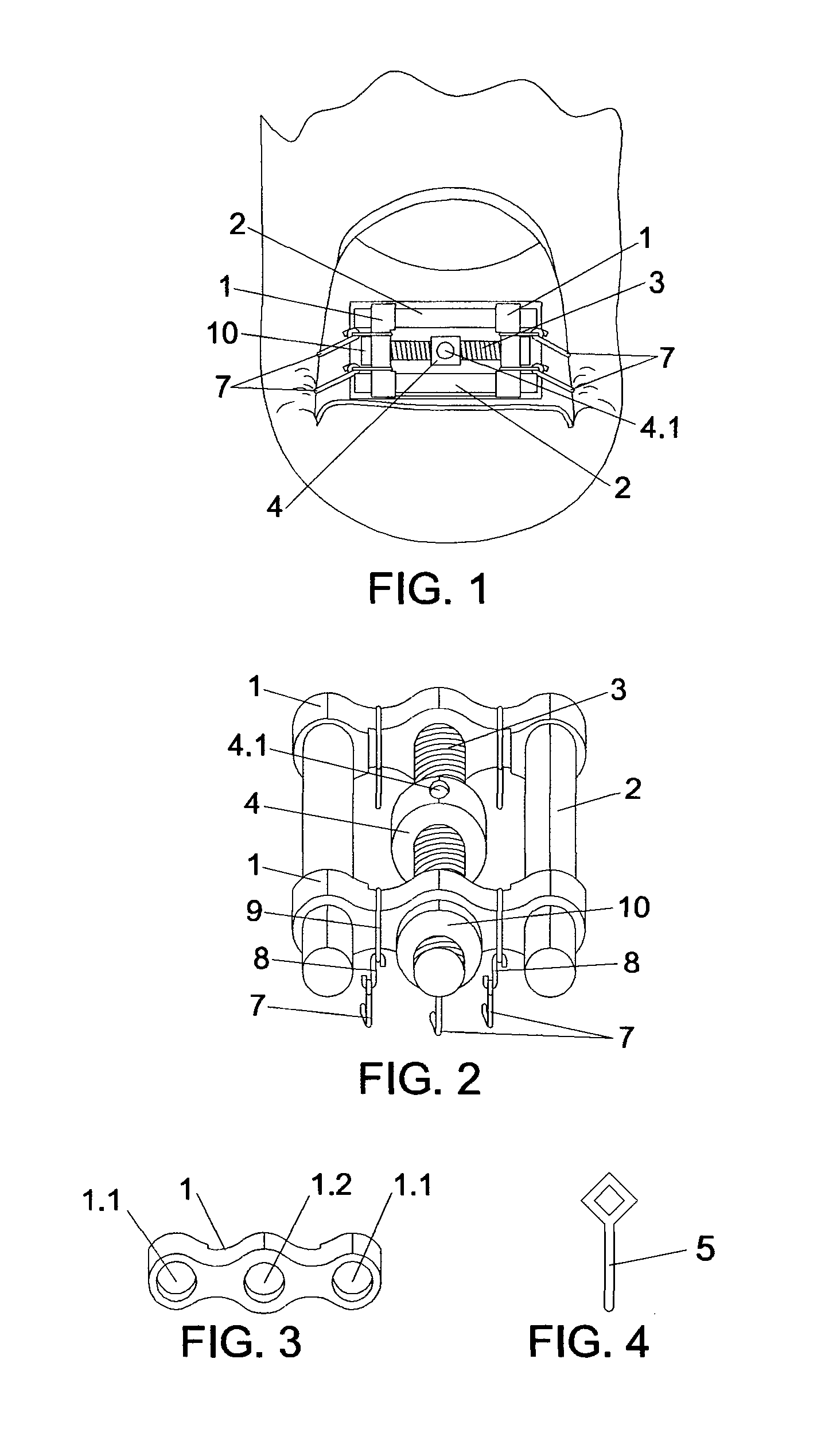 Screw nail correcting apparatus