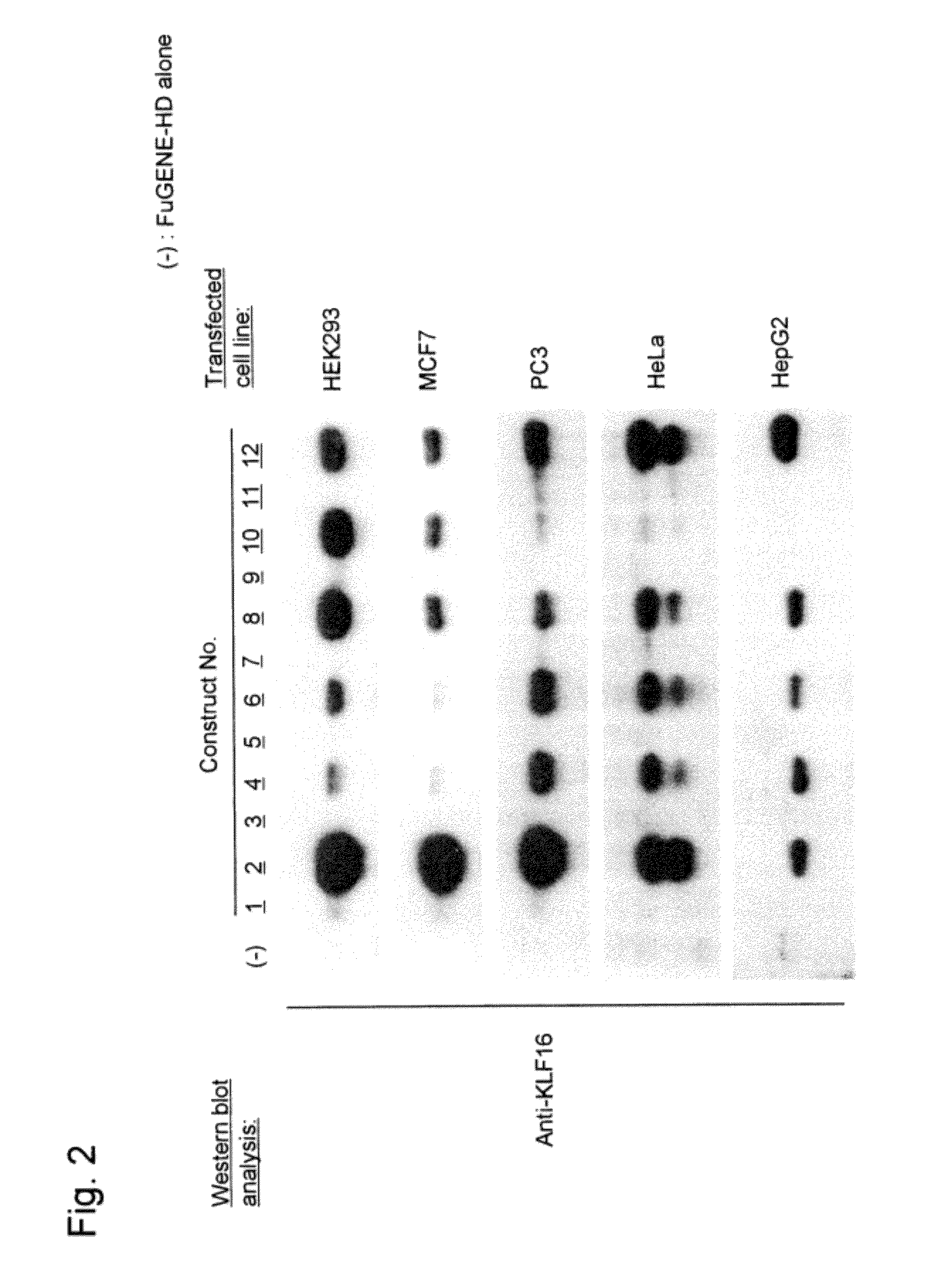 System for increasing gene expression and vector comprising the system