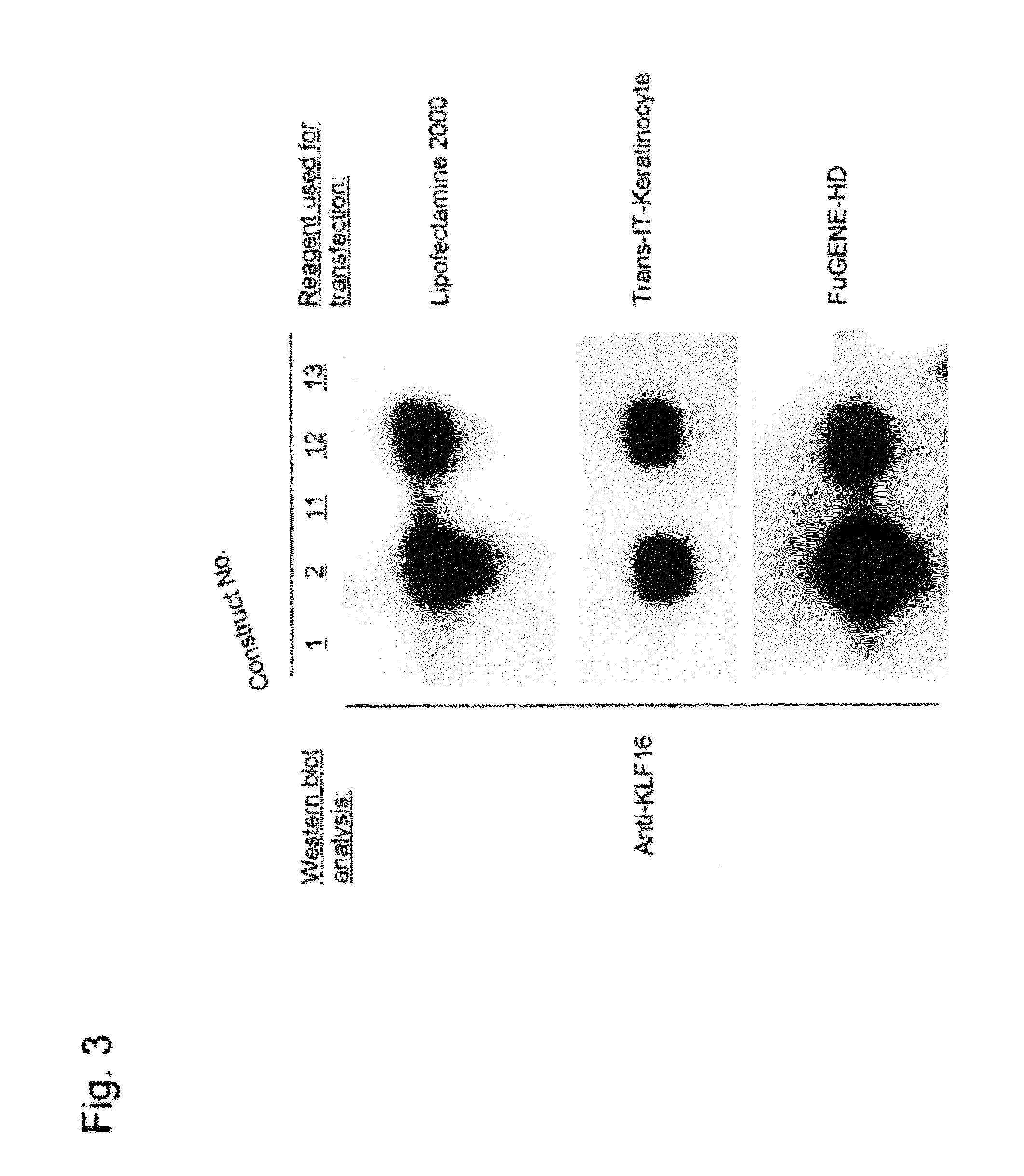 System for increasing gene expression and vector comprising the system