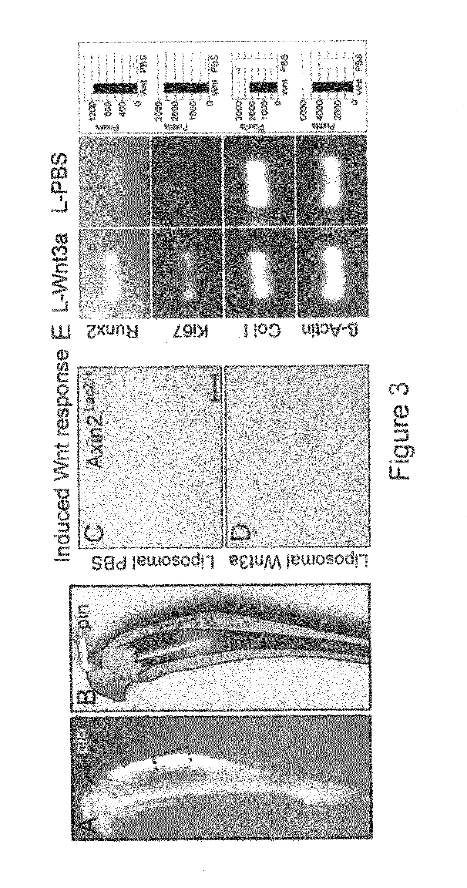 Use of liposomal Wnt composition to enhance osseointegration