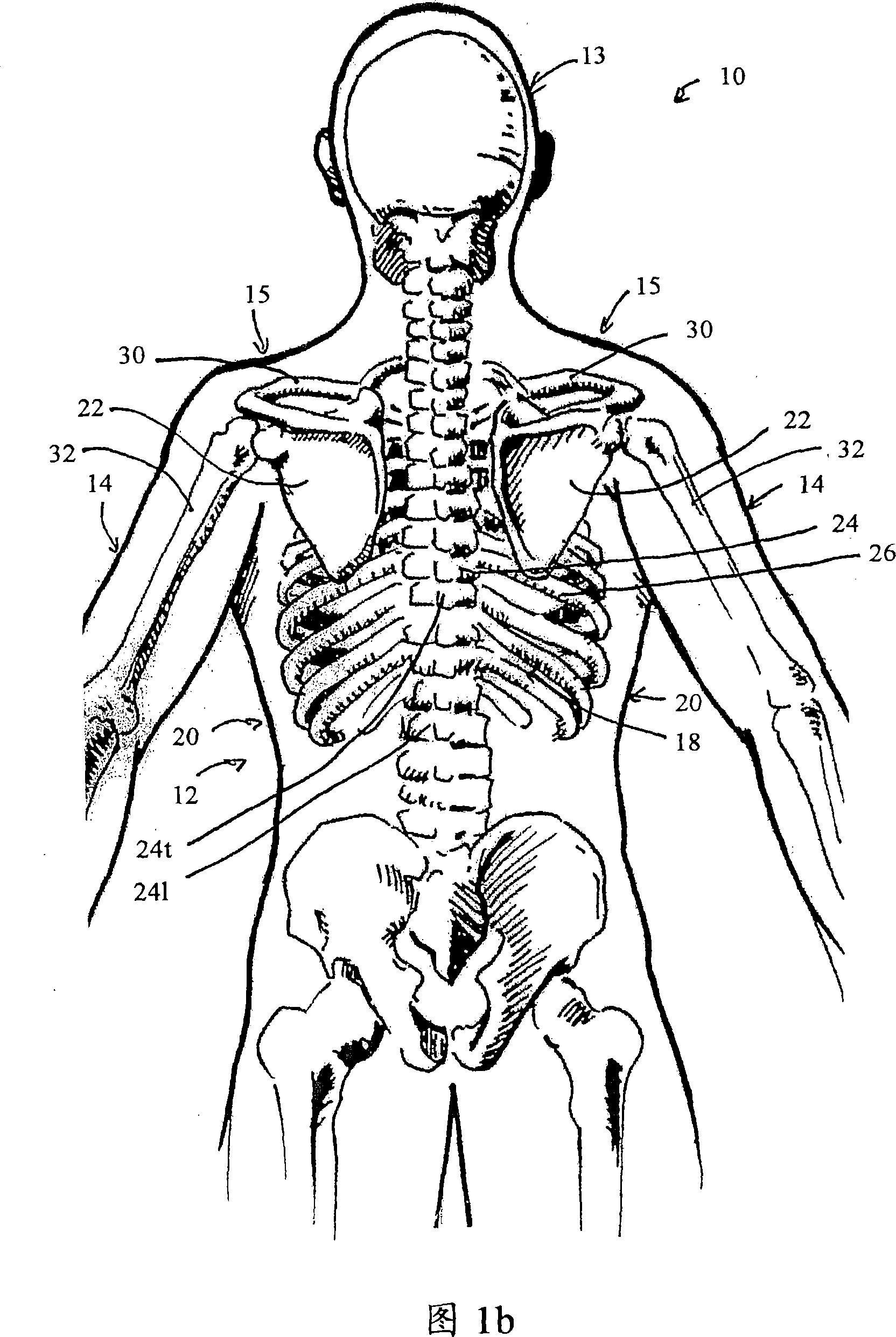 Posture support device