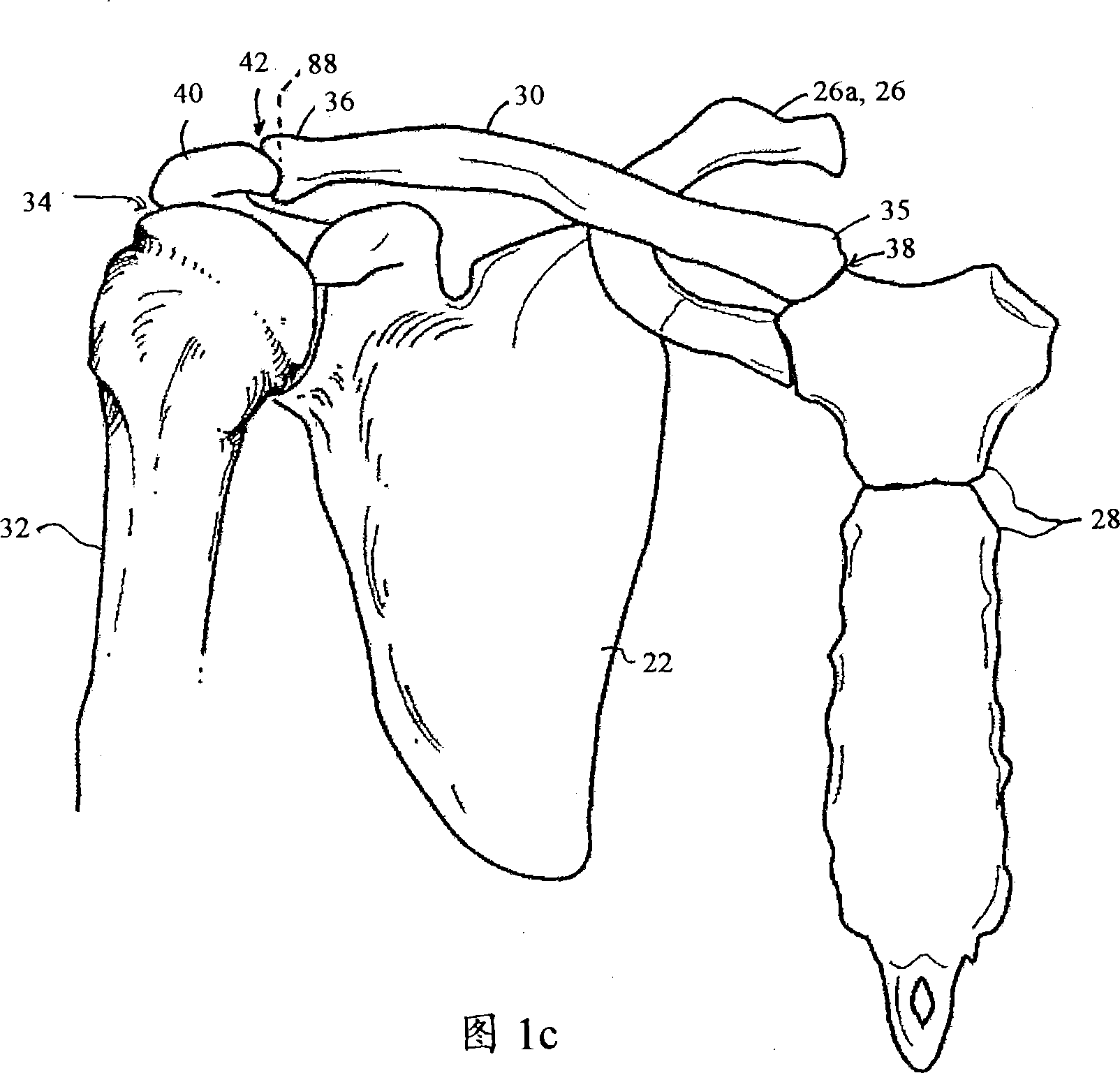 Posture support device