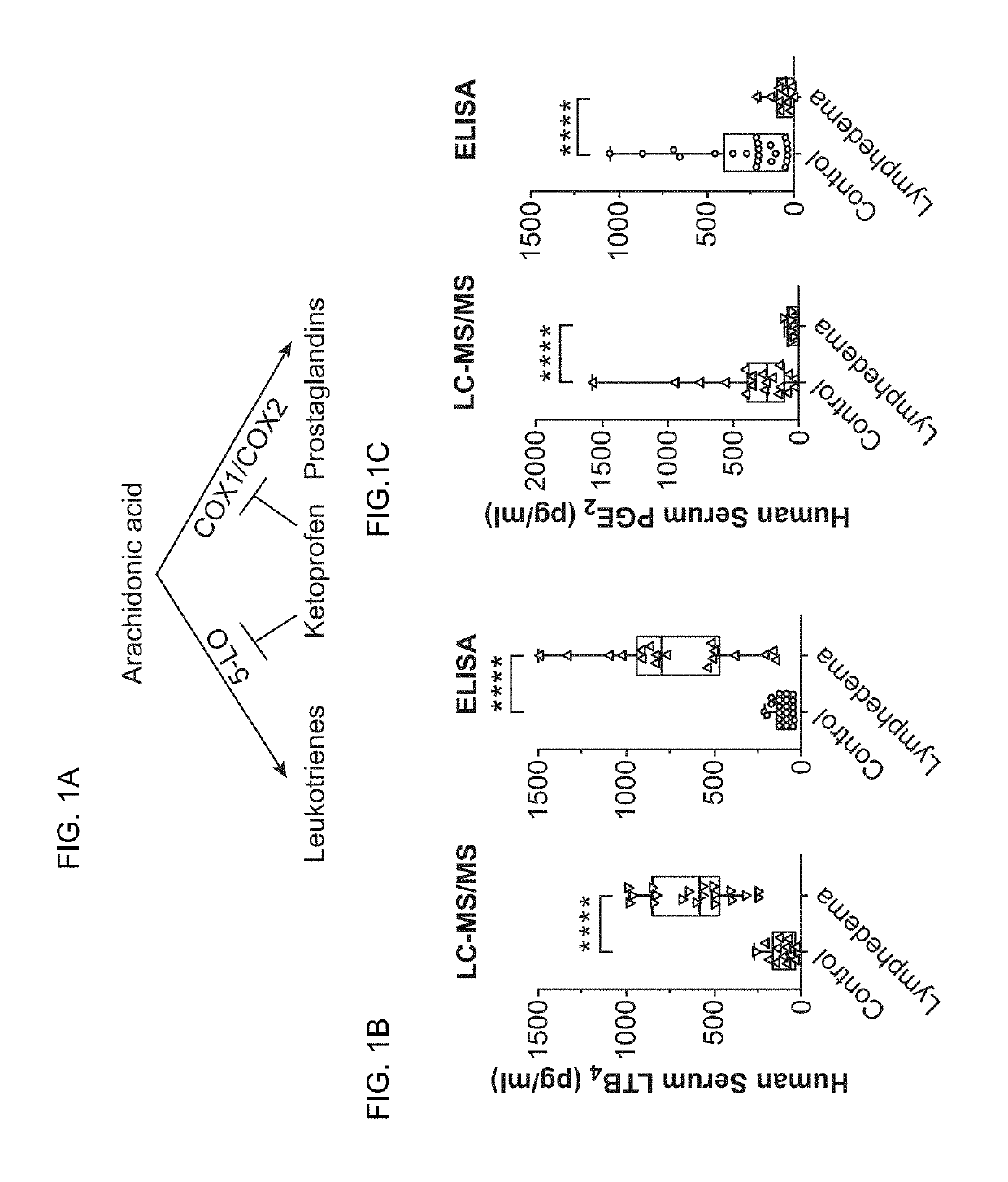 LTB4 inhibition to prevent and treat human lymphedema