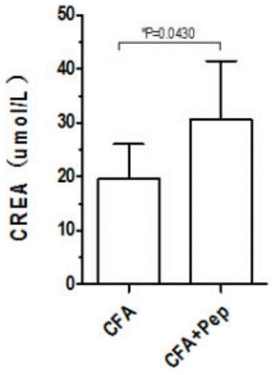 Nano vaccine of LAMP-2 epitope peptide and preparation method of nano vaccine