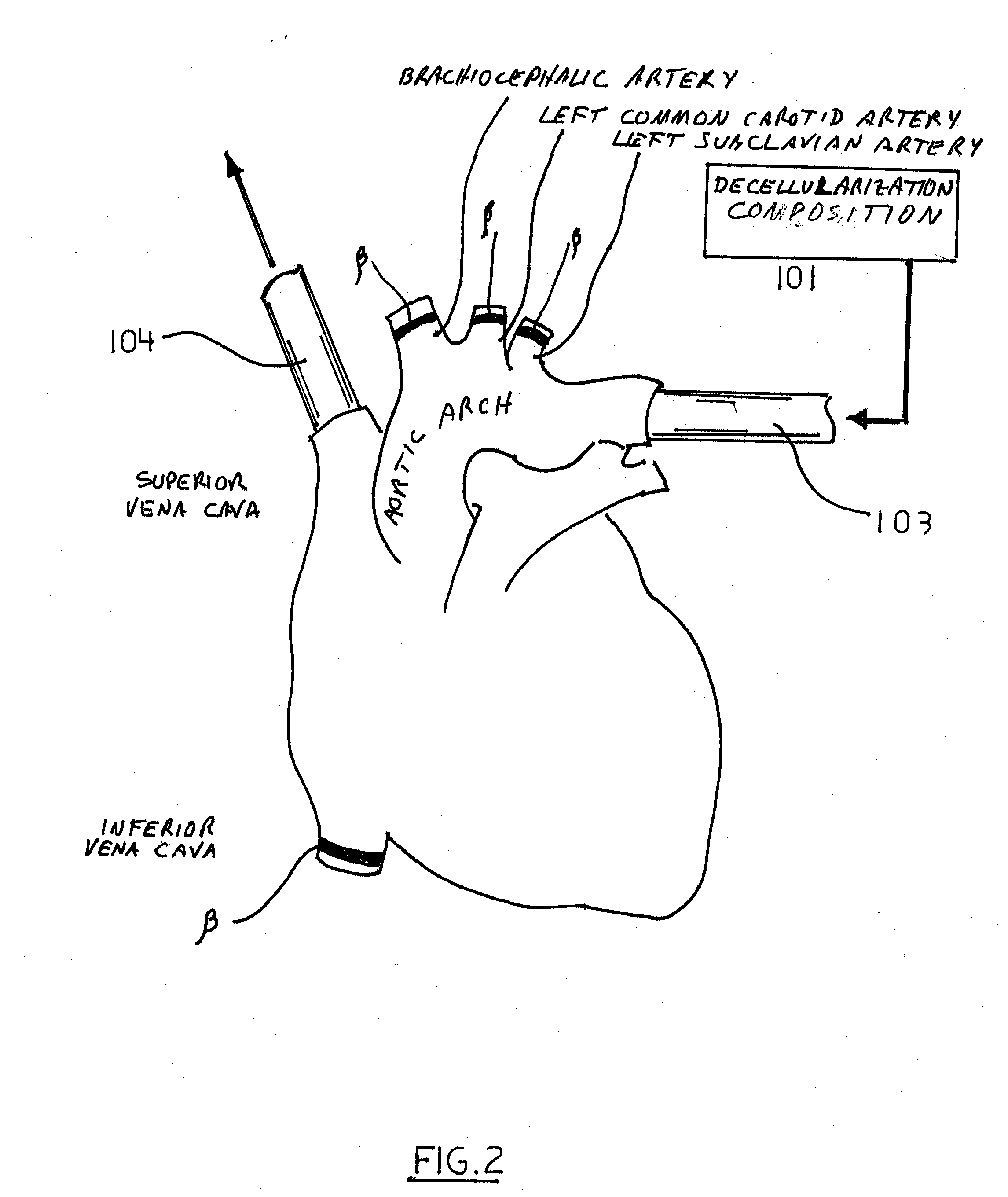 Decellularization and recellularization apparatuses and systems containing the same