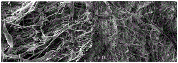 Decellularized anti-calcification heart patch and preparation method thereof