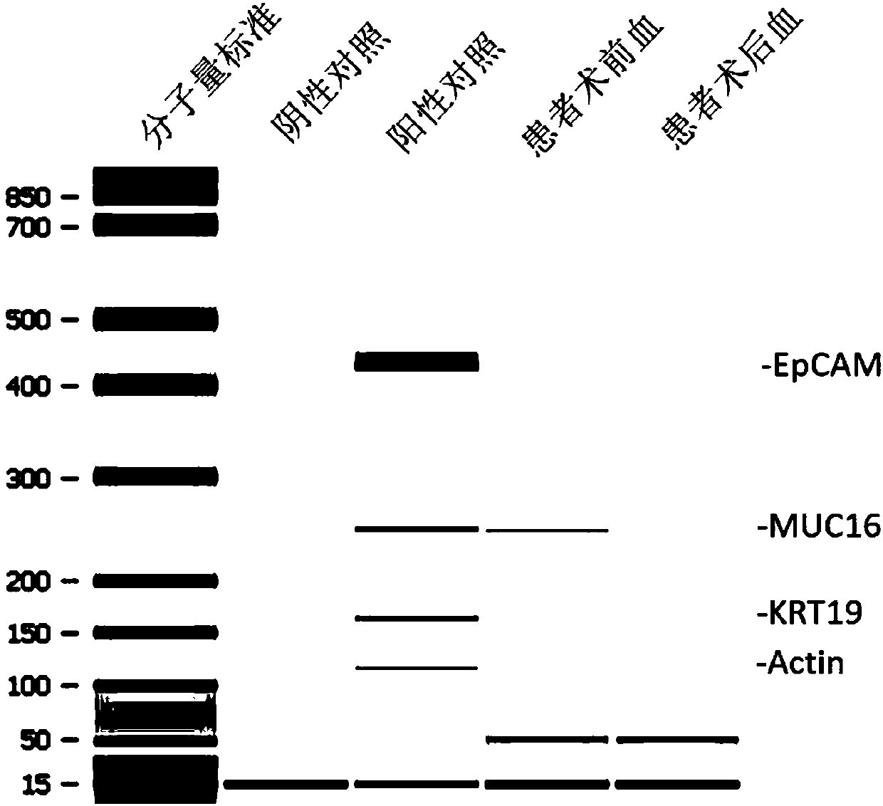 Kit for detecting pancreatic cancer cells in peripheral blood