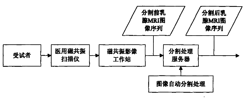 Image division method aiming at dynamically intensified mammary gland magnetic resonance image sequence