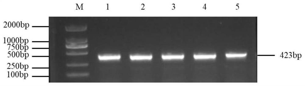 A SNP Molecular Marker Influencing Net Gross Rate of Alpine Merino Sheep and Its Application