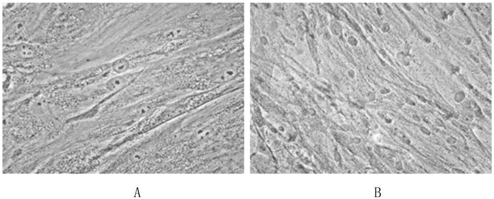 Periodontal ligament stem cell adipogenic differentiation inducing liquid and periodontal ligament stem cell adipogenic differentiation inducing method