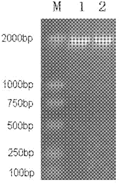 Kit for amplifying herpes simplex virus 1 (HSV-1) alkaline nuclease gene and method for expressing HSV-1 alkaline nuclease