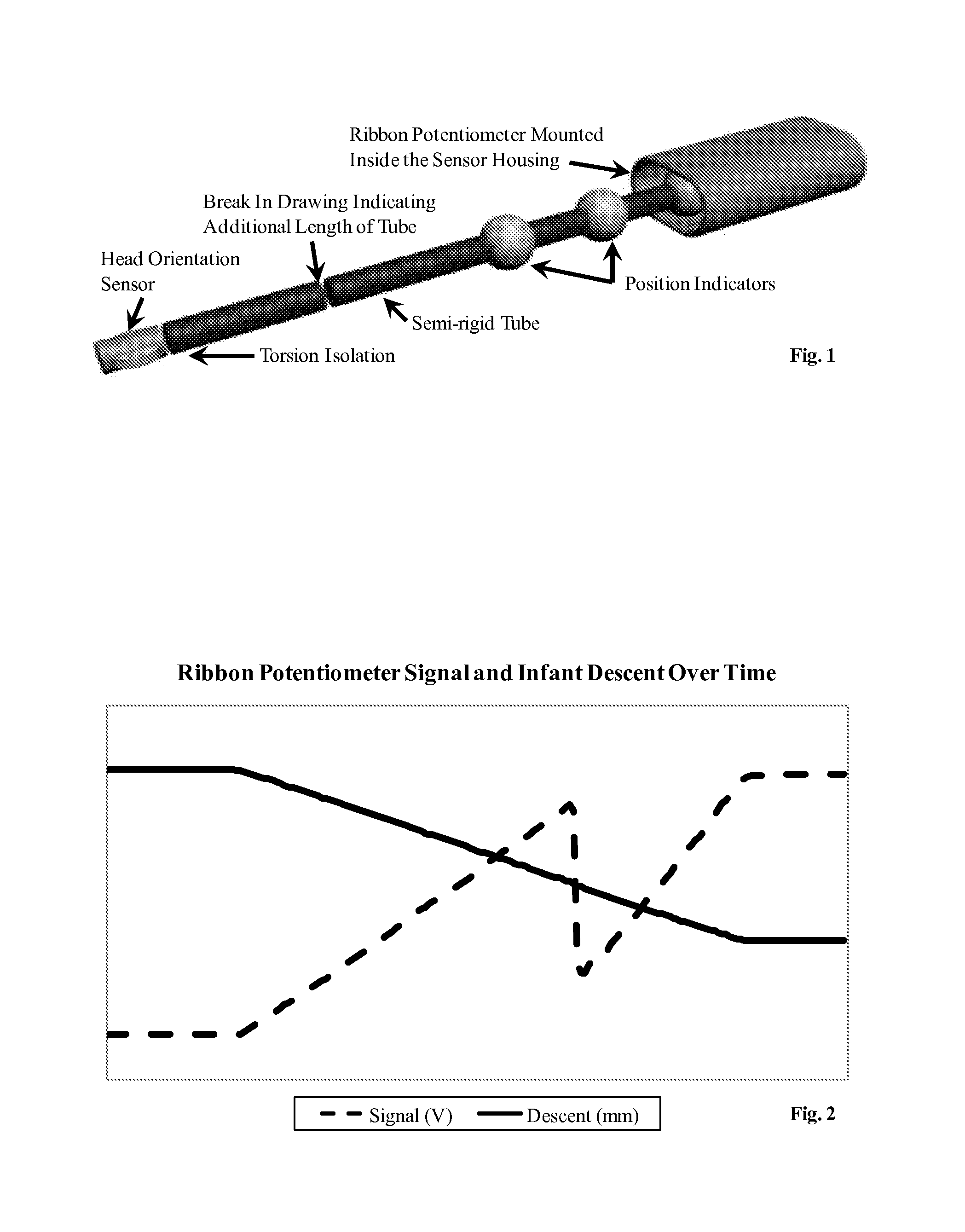 Method of measuring fetal head orientation, position, and velocity and providing feedback to mother and doctor