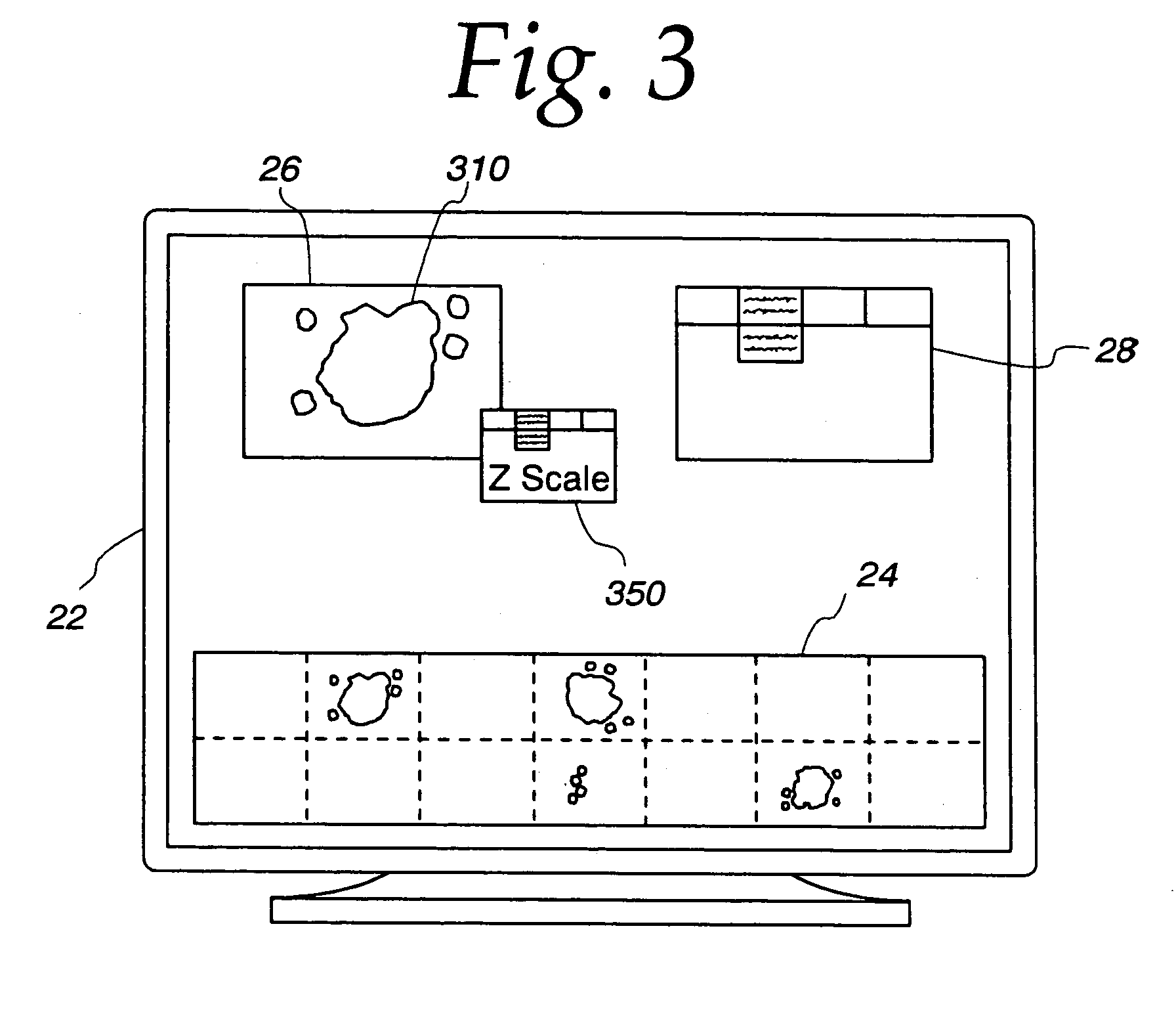 Apparatus for remote control of a microscope