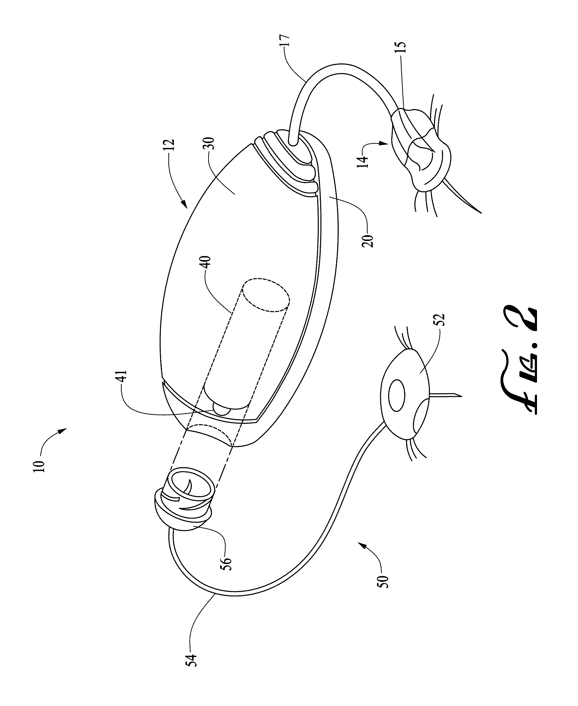 Transfer guard systems and methods