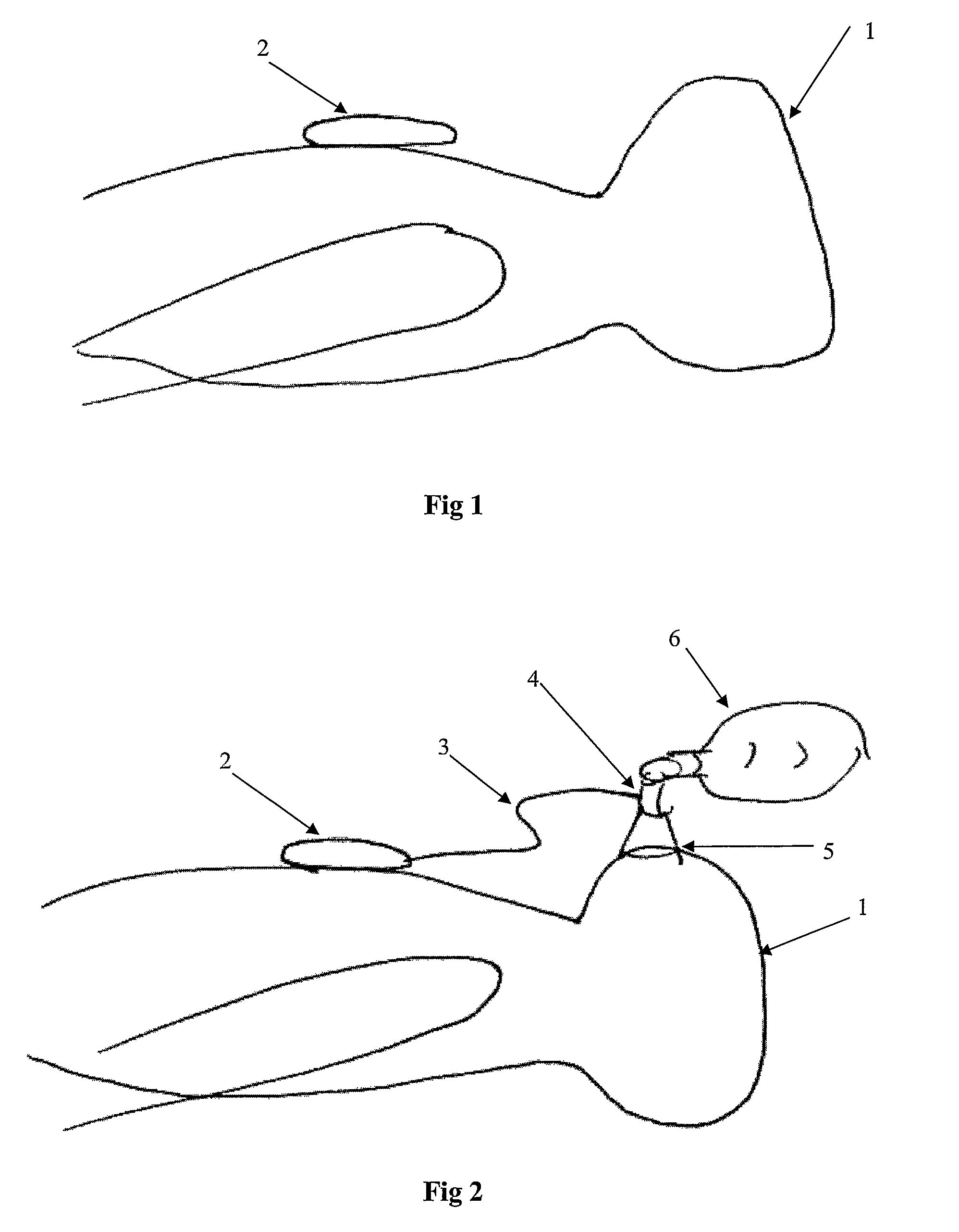 Standalone system for assisting in a life-saving situation