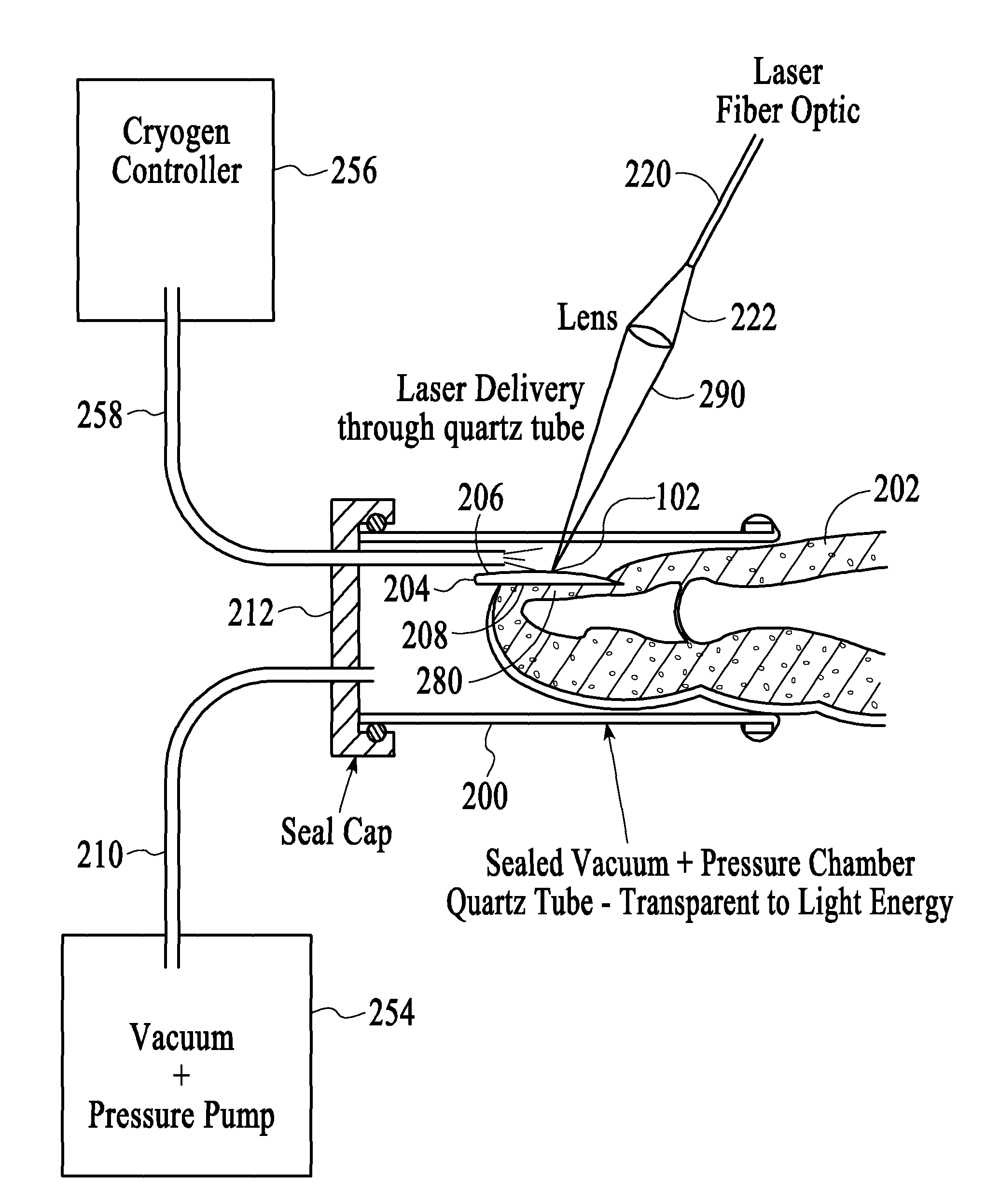 Method for treatment of fingernail and toenail microbial infections using infrared laser heating and low pressure