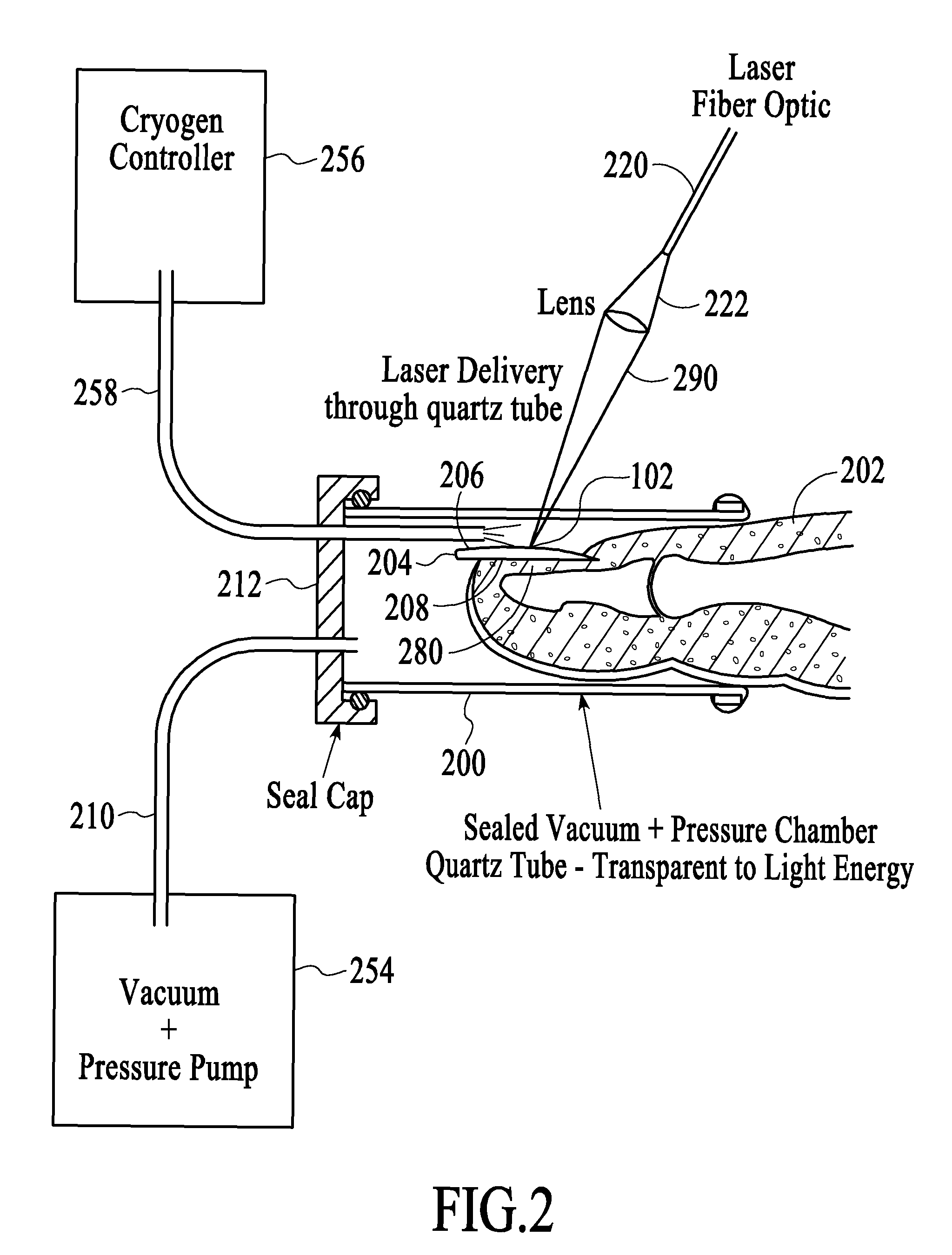 Method for treatment of fingernail and toenail microbial infections using infrared laser heating and low pressure